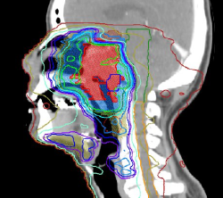 Contouring image